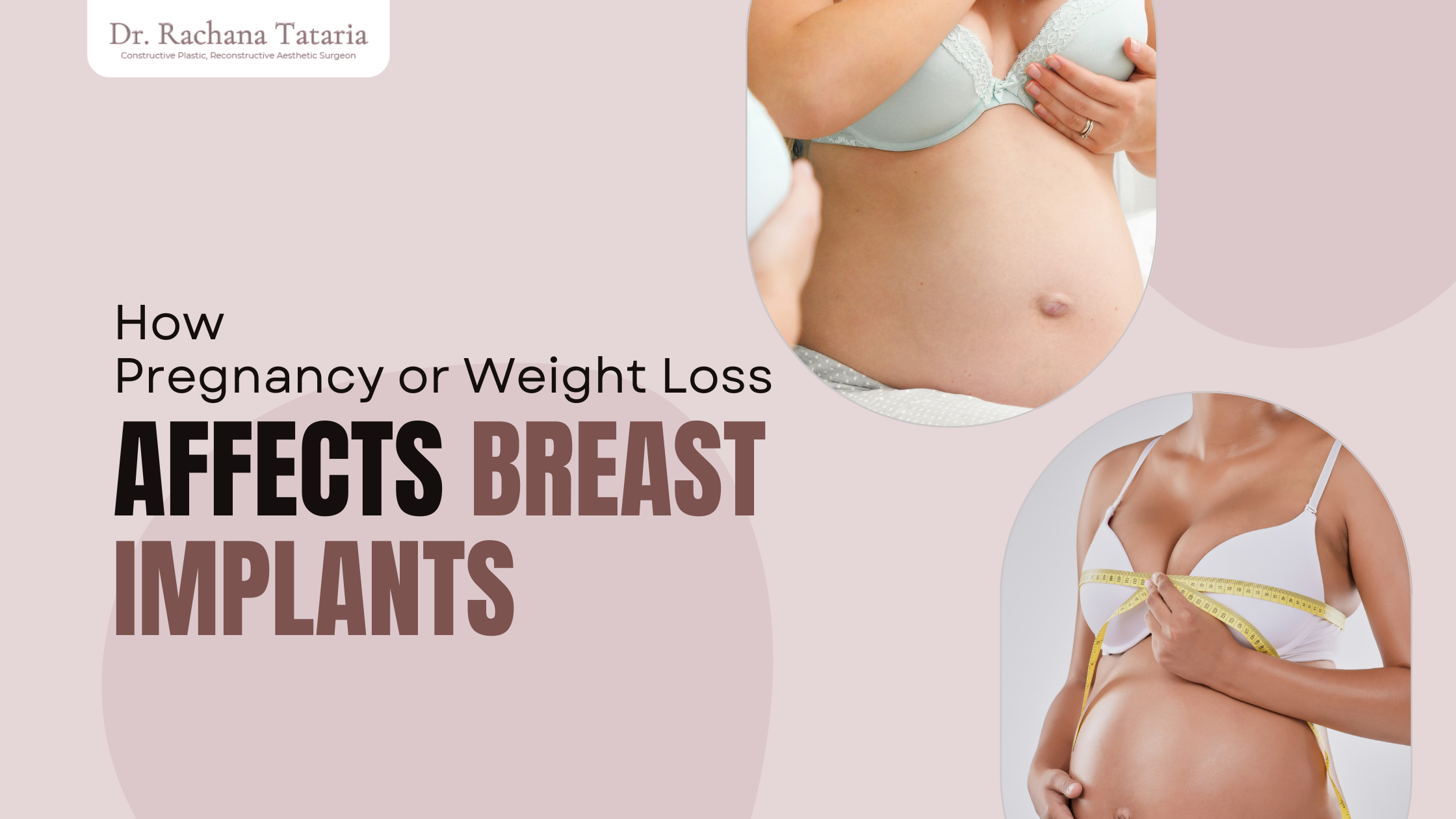 Breast Implants After Pregnancy